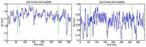 Algorithms Based on CWT and Classifiers to Control Cardiac Alterations ...