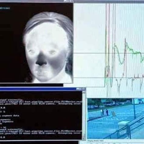 Image result for Neural Monitoring Software
