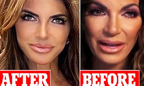 Teresa Giudice Looks Unrecognizable As Doctors Reveal What, 60% OFF