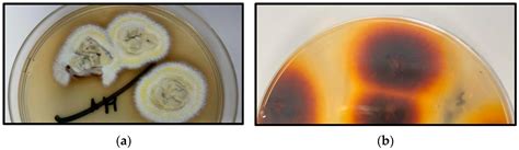 Tinea Capitis Induced by Barber Shaving: Isolation of Trichophyton ...