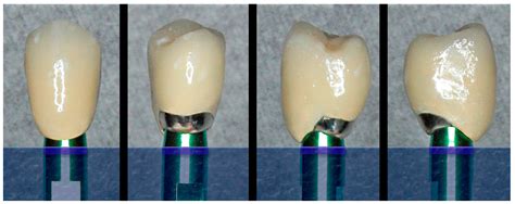 Analogical and Digital Workflow in the Design and Preparation of the ...