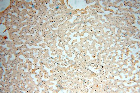 VAV1 antibody (16364-1-AP) | Proteintech