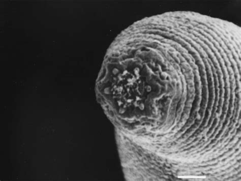 What A Worm Looks Like Under Microscope at Joseph Stanfield blog