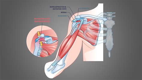 4 Best Rotator Cuff (Shoulder) Impingement Exercises (with Pictures!) - Inspire US