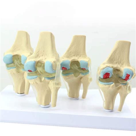 Hx Knee Joint Model Human Anatomy Science Models Human Skeleton ...