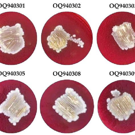 Image result for Enterococcus Faecalis Hemolytic Activity