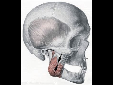 Image result for Masseter Muscle Trigger Point