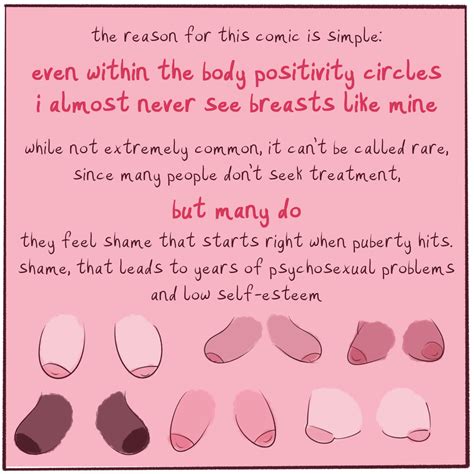 Hypoplastic Tubular Breast