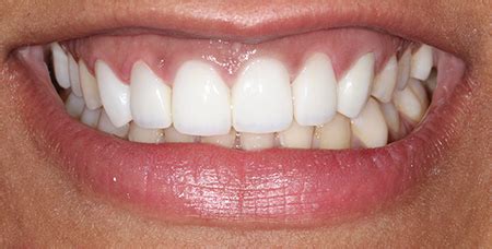 Our Work | Kamala Dental Care