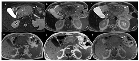 A Systematic Review about Imaging and Histopathological Findings for ...