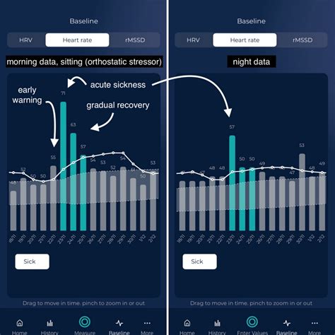 Image result for Heart Rate Variability Test