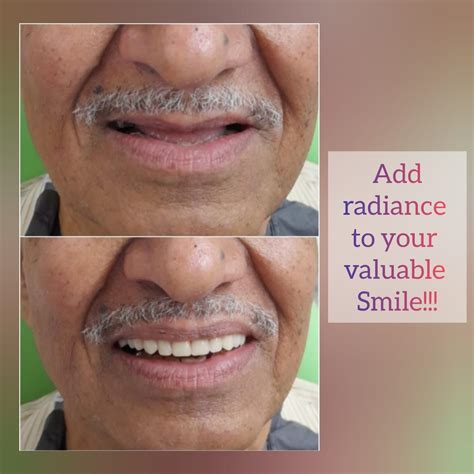 Image Gallery | Dr Patil's Face N Dental International Clinic ...