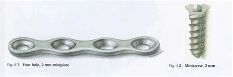 Orthopedic Locking Plates - SAFEX INC 2.4 Mm Locking Instruments Set ...
