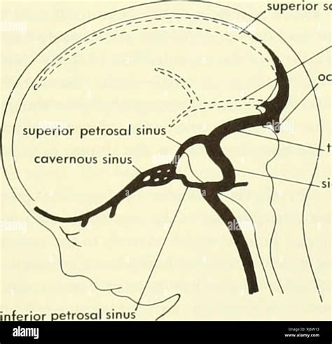 Superior sagittal sinus hi-res stock photography and images - Alamy