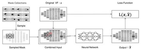 VF-Mask-Net: A Visual Field Noise Reduction Method Using Neural Networks
