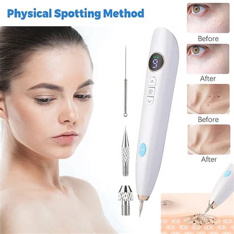 Skin Tag Remover Wart Berrugas Eliminator Lcd Plasma Pen Papillomas ...
