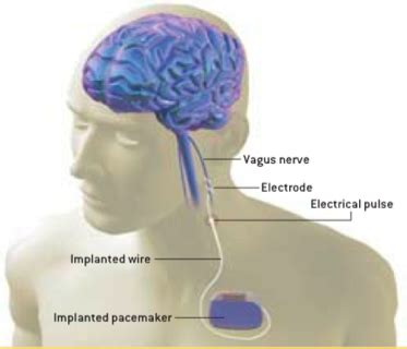 ASHTANGA VINYASA YOGA, VAGUS NERVE , AMYGDALA – CAPT AJIT VADAKAYIL ...