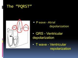 Basic EKG Class 的图像结果