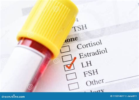 Luteinizing hormone test stock image. Image of hormone - 115314617