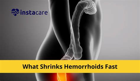 What Shrinks Hemorrhoids Fast