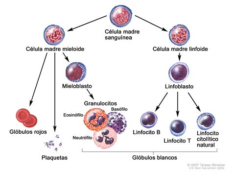 Tratamiento de la leucemia mieloide aguda y otras neoplasias mieloides ...