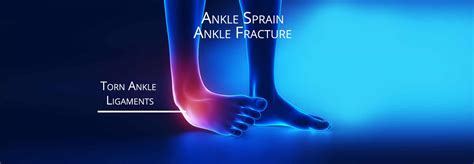 Ankle Sprain - Ankle Fracture - Torn Ligament or Tendon - Self Healing ...