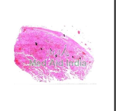 Prepared Microscope Slide - Histopathology Slides Manufacturer ...