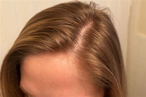 The best hair growth oils and serums for 2026, tested and reviewed