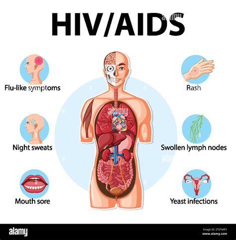 Illustrated infographic depicting the impact of HIV/AIDS on the body's ...