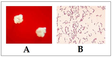 The Pathogenic Role of Actinomyces spp. and Related Organisms in ...