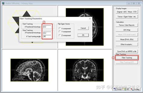Computer Science DTI 的图像结果