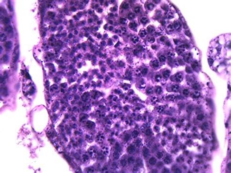 Grasshopper Testis, Wholemount - Prepared Microscope Slide - 75 x 25mm ...