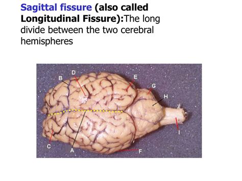 PPT - Brain Anatomy Tutorial: The Tree of Life in Cerebellum and ...