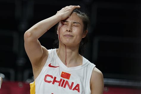 中国女篮王思雨飙血砍出全场最高，“头开了不疼，倒觉得该我站出来了！”