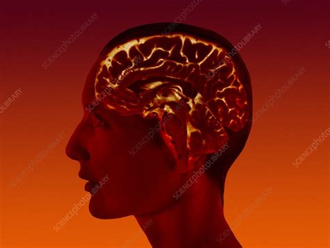 Image result for Add Brain Scan