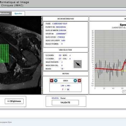LC Model Spectroscopy Software 的图像结果