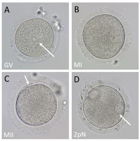 A Comparison of Oocyte Yield between Ultrasound-Guided and Laparoscopic Oocyte Retrieval in ...