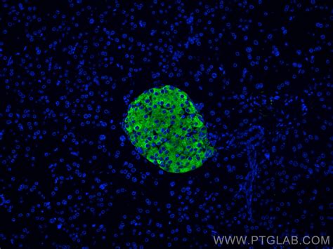 Synaptophysin antibody (17785-1-AP) | Proteintech