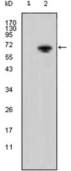 Anti-Wnt-5a Antibody, clone 6F2 | MABD136