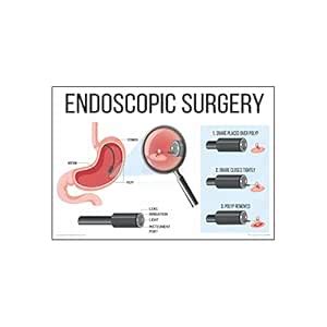 Anne Print Solutions® Endoscopic surgery Posters For Hospital Posters ...
