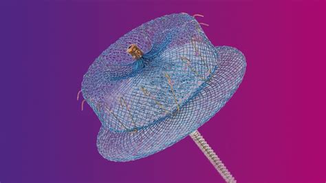 FDA Approves Abbott’s Amplatzer Amulet LAA Occluder To Compete With ...