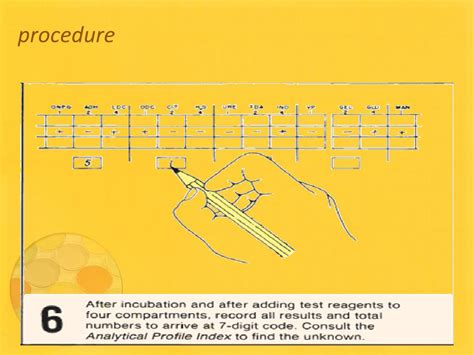 Image result for API 20E System