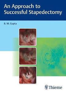 An Approach to Successful Stapedectomy: Buy An Approach to Successful ...
