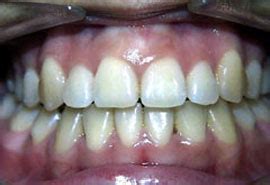 Best Dental Clinic in New Delhi, Dentist in Delhi, Dental Clinic South ...