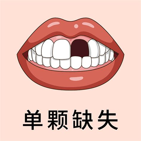 分享一例活动义齿修复病例-单陈鹏的博客-KQ88口腔博客
