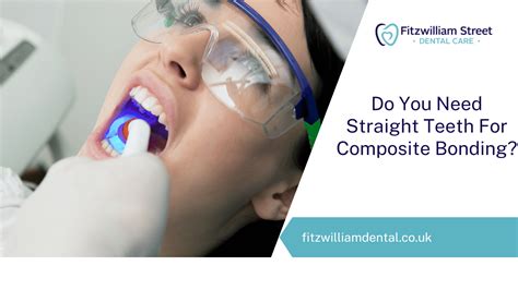 Dental Bonding: What Is Teeth Bonding & What To Expect? - Fitzwilliam Street Dental Care