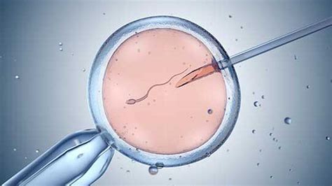 In-vitro-Fertilisation immer öfter erfolgreich - - Universimed ...