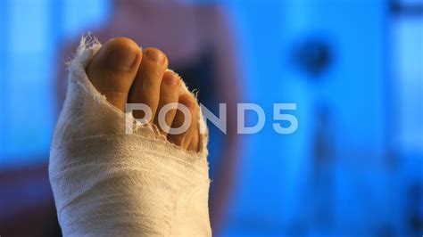 Broken Ankle Cast Blue