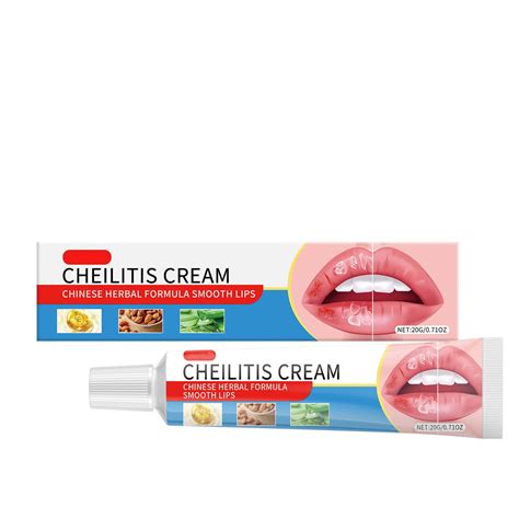 langlia Hydrating Lip Cream, Cheilitis Treatment, Moisturizing Lip Repair, Soothes Cracked Lips ...