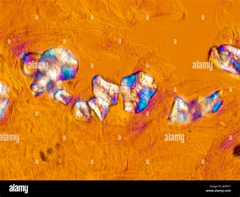pear bulb pulp pear bulb pulp microscope polarization peach steinzellen ...